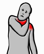 Neck Pain