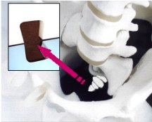 The Triple-CV Coccyx Cushion